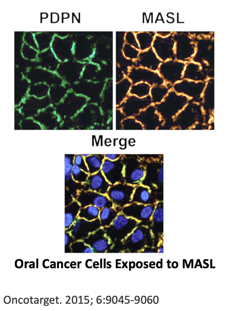 MASL Efficiently Targets PDPN, an Early Expressed Biomarker Essential to Contact Normalization